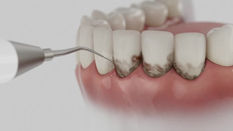 Trusted Emergency Dentist service in Quartz Hill, CA - Dentist Open Now